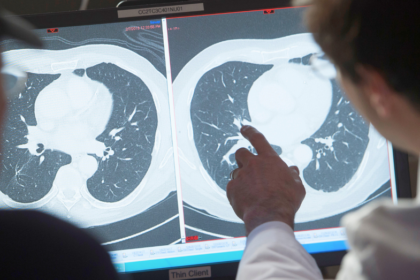 A cure for cancer would deliver $185T economic windfall, report says