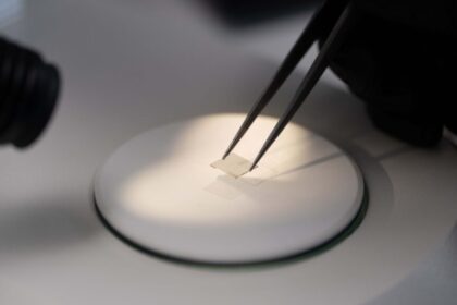 Vera Clinic and Appsilon Unveil Vector 10: The World’s First CVD Lab-Grown Diamond-Tipped Blade Engineered for Hair Transplant Surgery