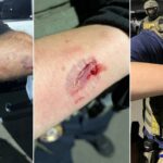 Anti-ICE agitator charged with allegedly biting officers during Delaney Hall clashes